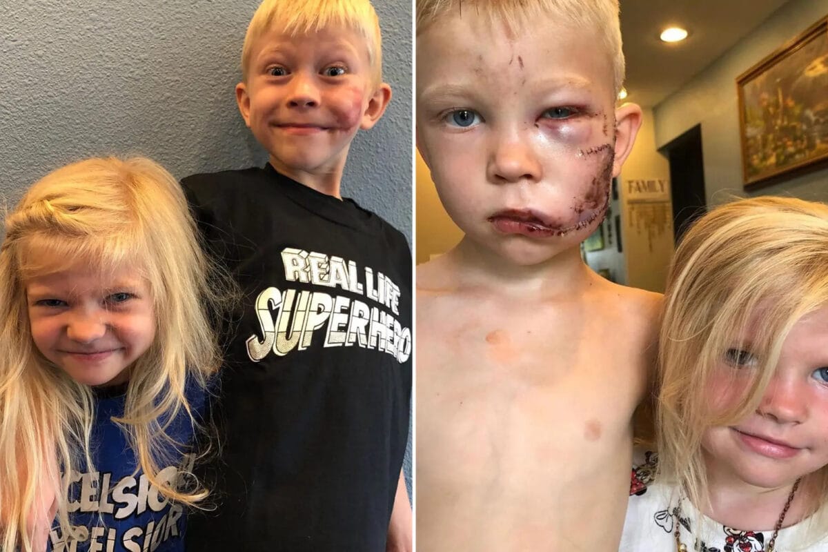 the boy who saved his sister from dog attack